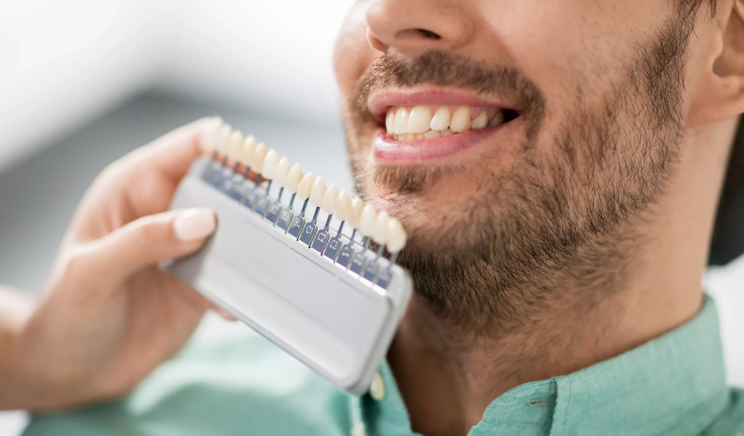 Newport Beach Dentist Chairside Teeth Whitening