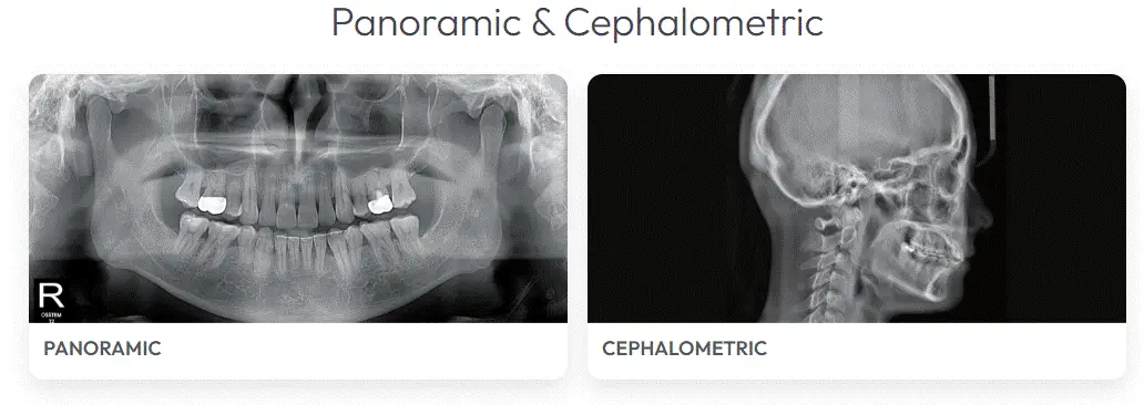 Osstem T2 CBCT Orange, CA Cephalometric