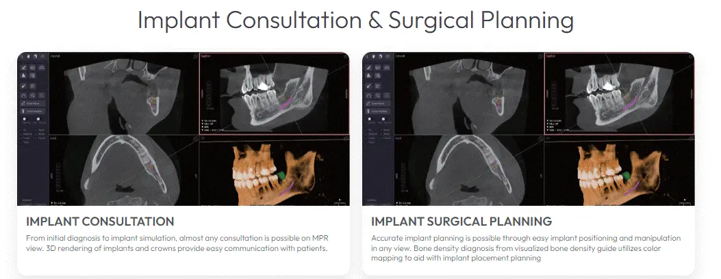 Osstem T2 CBCT Orange, CA Implant Consultation