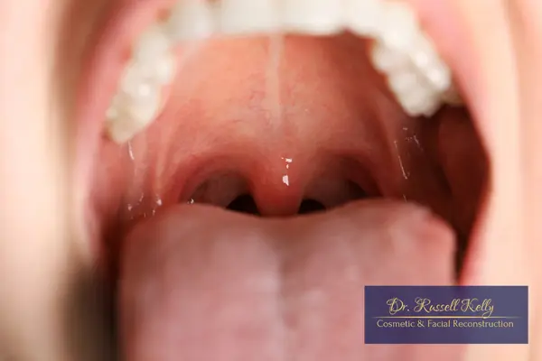 The Mouth-Body Connection_ Why Your Smile Reflects Your Health