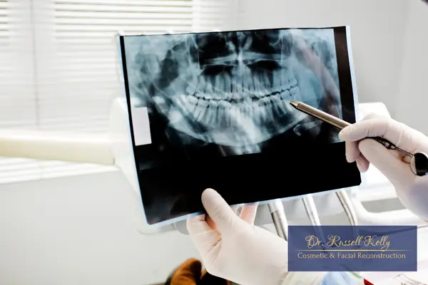 Dr. Russell Kelly using digital X-rays to detect hidden dental risks at Orange, CA office